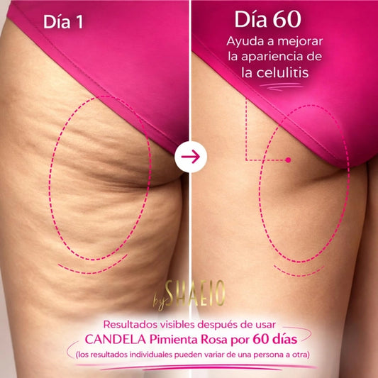 CANDELA by Shaeio Crema Anticelulitis y Estrías